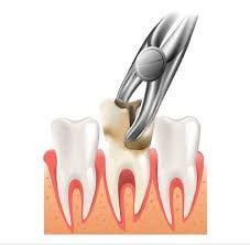 Oral Surgery